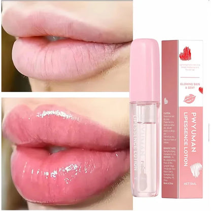 Auralis® Korean Juicy Lip Filler™